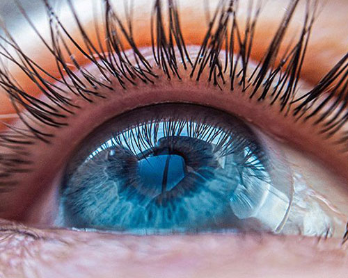 Eye with contact lens